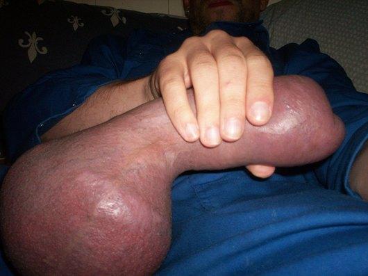 Pics cbt testicle